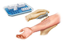 Prick Test Uygulaması